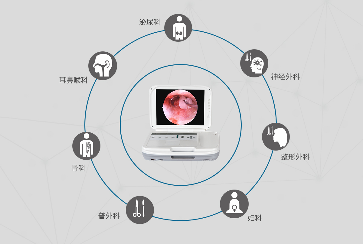 內(nèi)窺鏡攝像機(jī)的應(yīng)用領(lǐng)域有哪些？