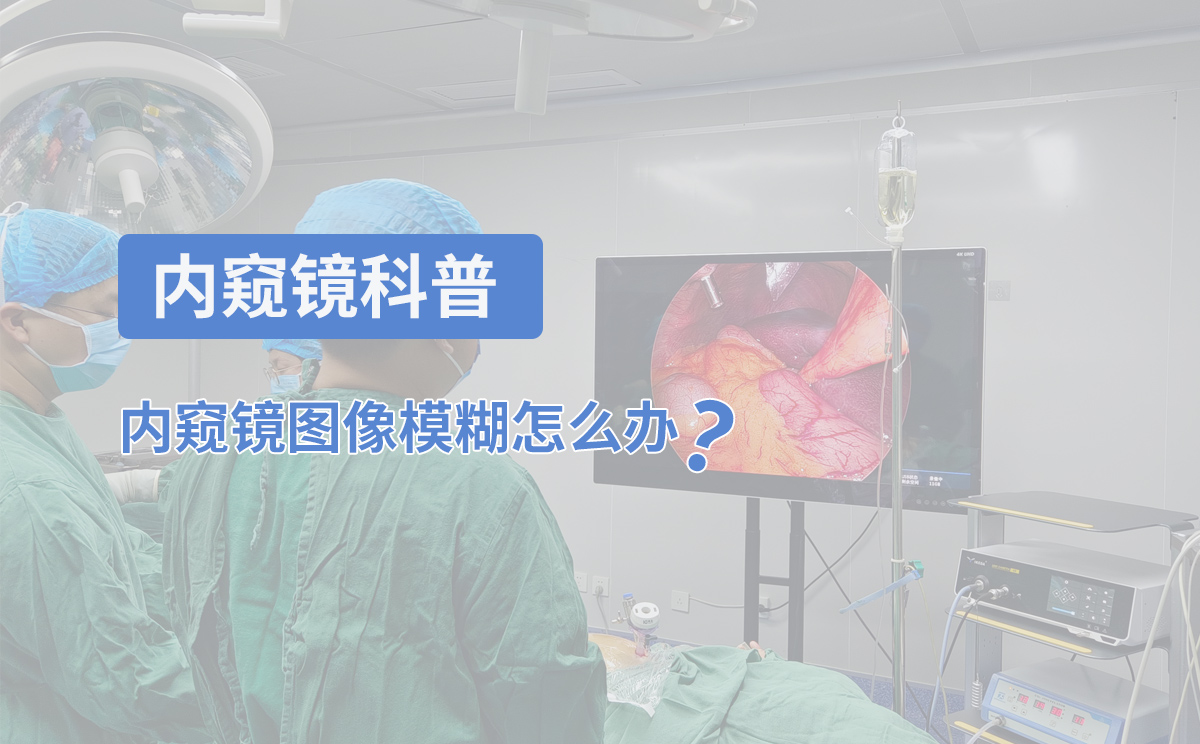 內(nèi)窺鏡科普：內(nèi)窺鏡圖像模糊怎么辦？