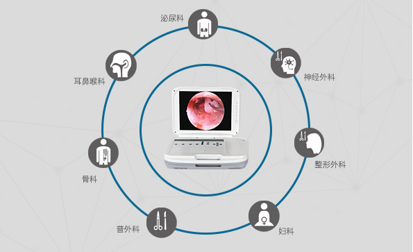 內(nèi)窺鏡攝像機的應用領域有哪些？