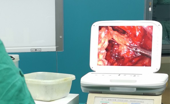 【腹腔鏡篇】腹腔鏡疝氣手術，您知道嗎？