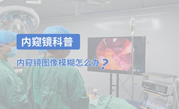 內窺鏡科普：內窺鏡圖像模糊怎么辦？